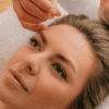 Acupuncture du visage | Treatwell