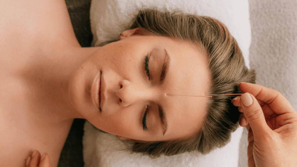 Acupuncture du visage_3 | Treatwell