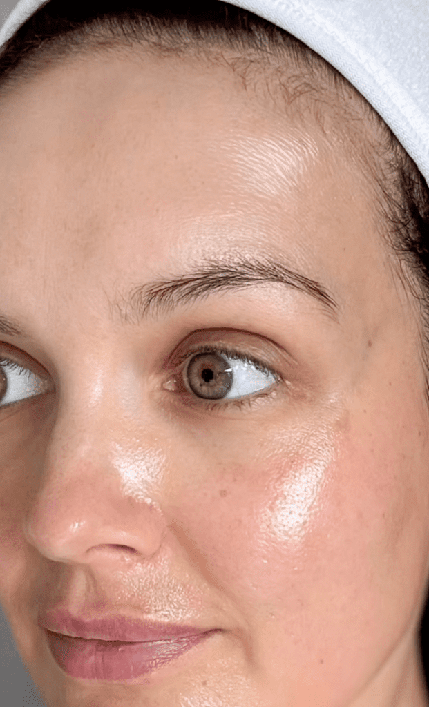 Peeling à la vitamine C, IG @skincarebyjoanne | Treatwell